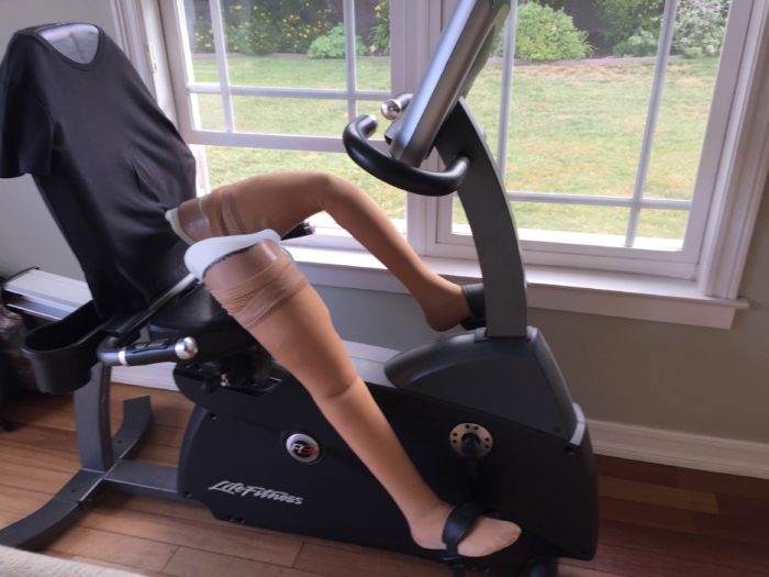artificial legs on recumbent bike